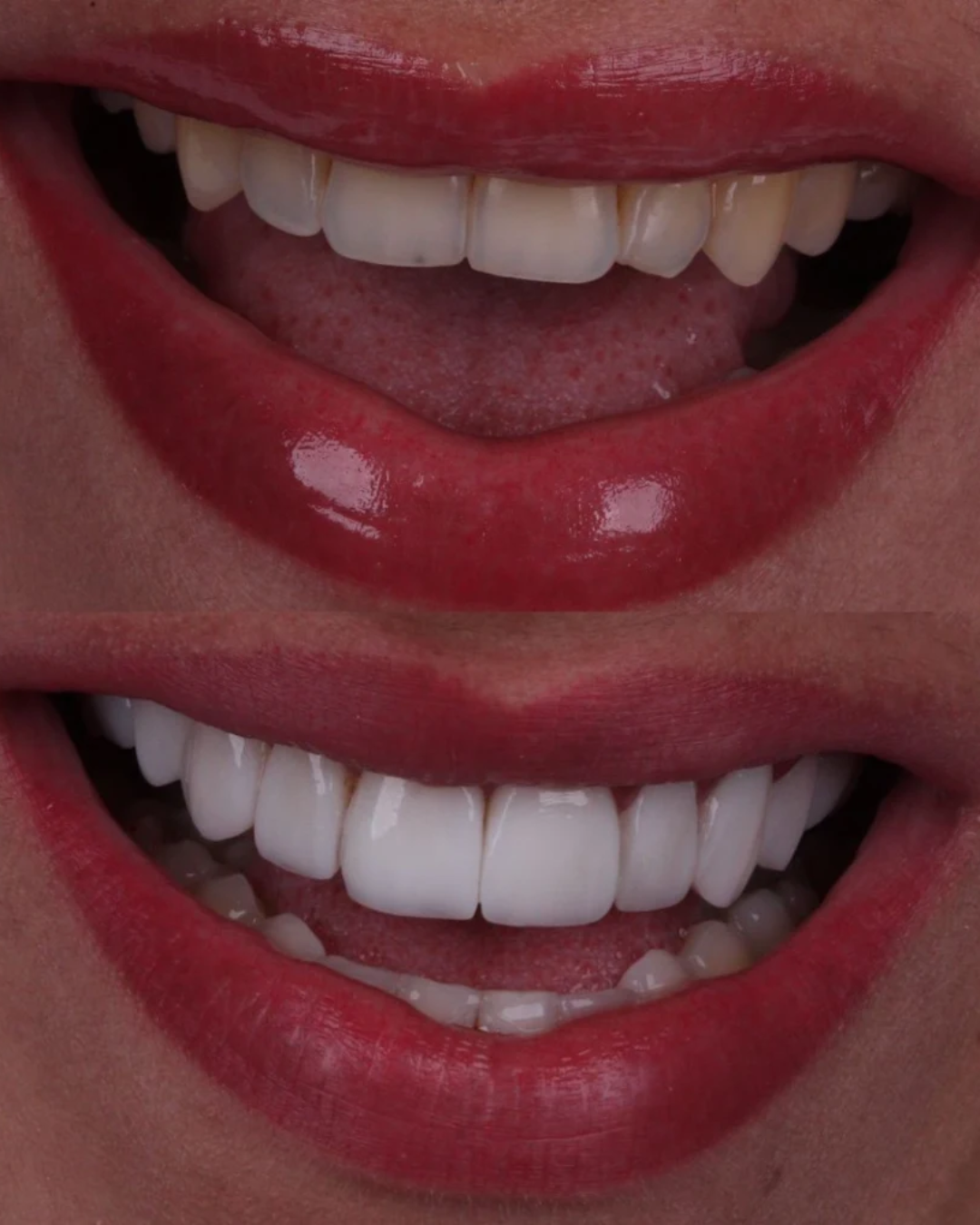 Antes e Depois 3